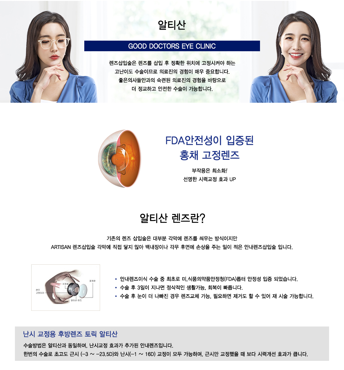 토릭아쿠아ICL