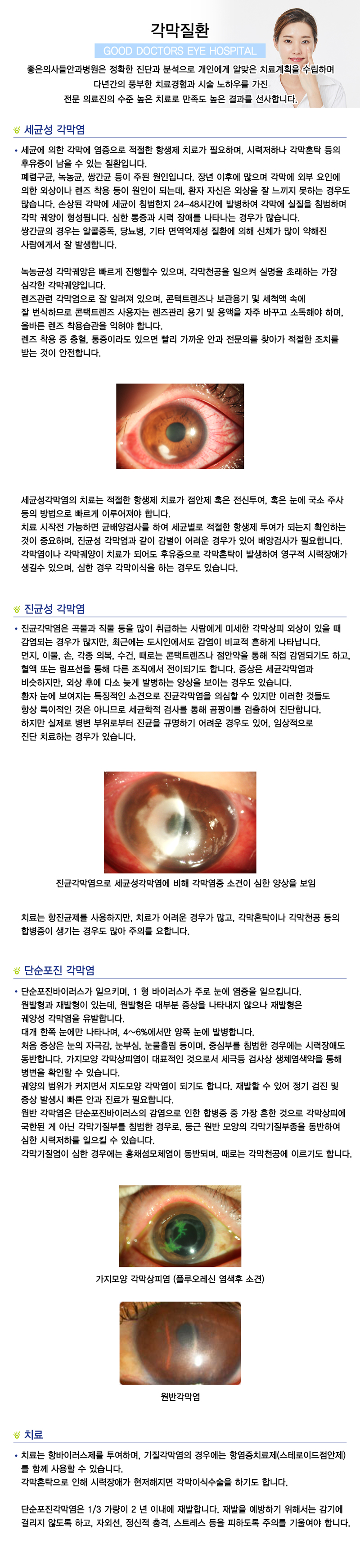 각막질환