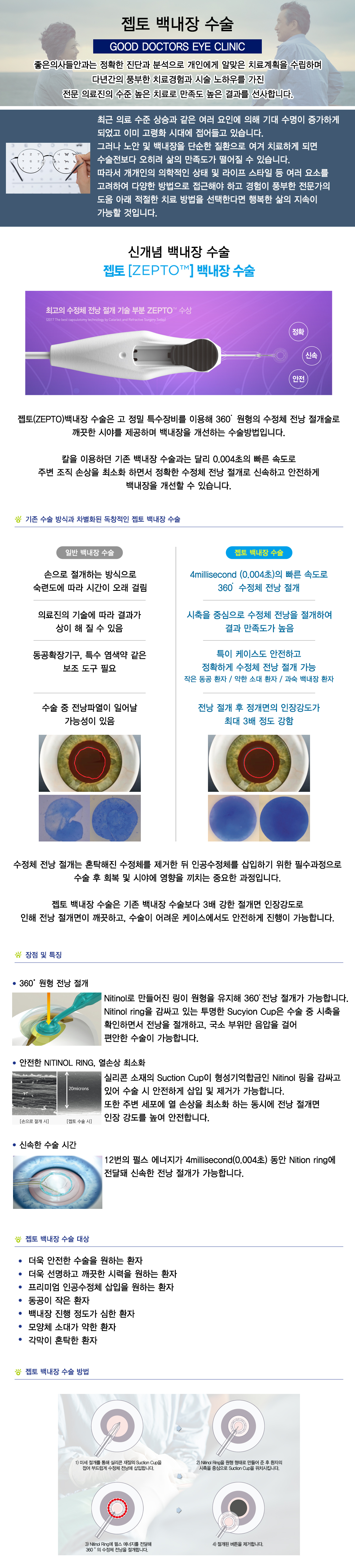 노안이란